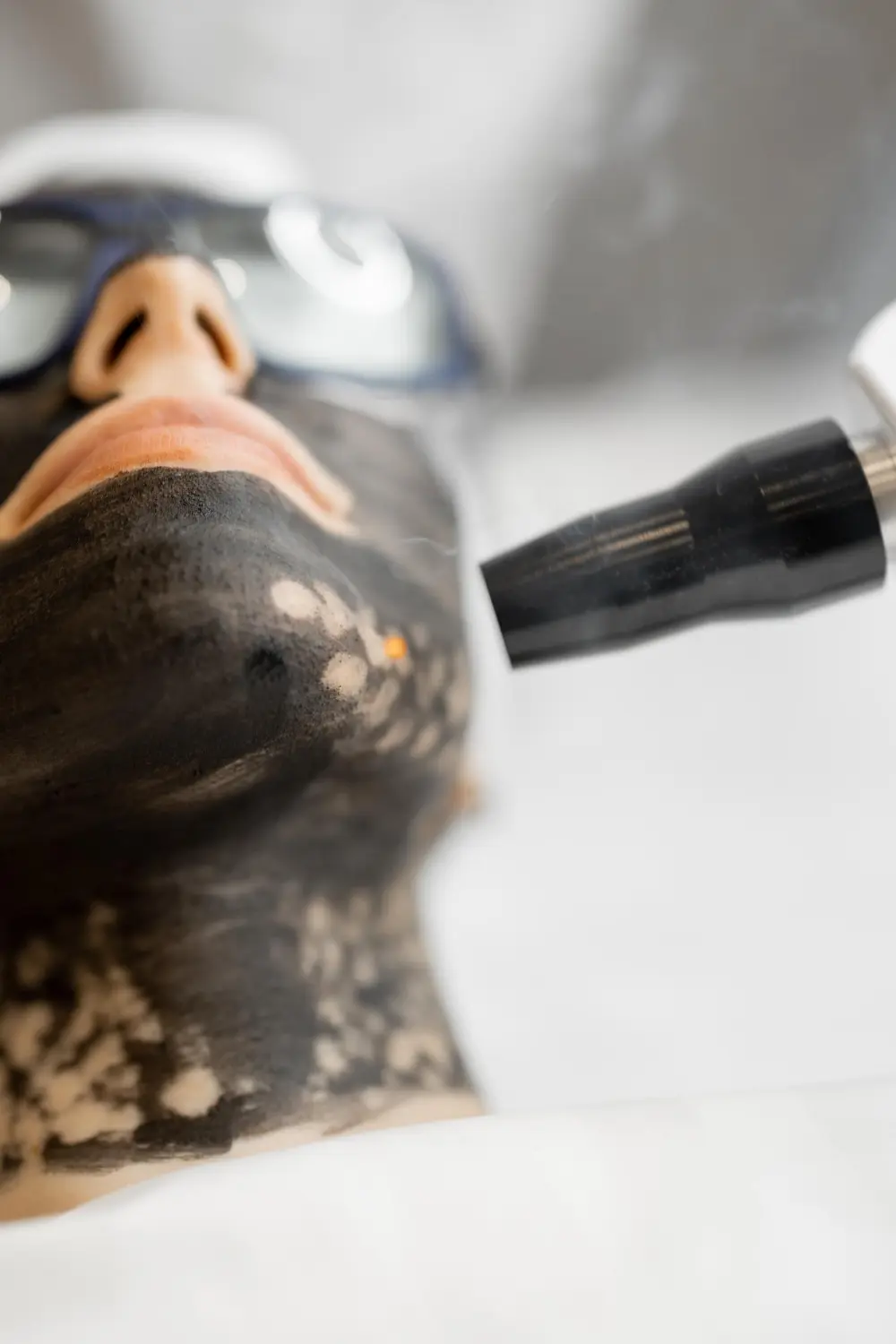 Carbon laser facial Hollywood Peel